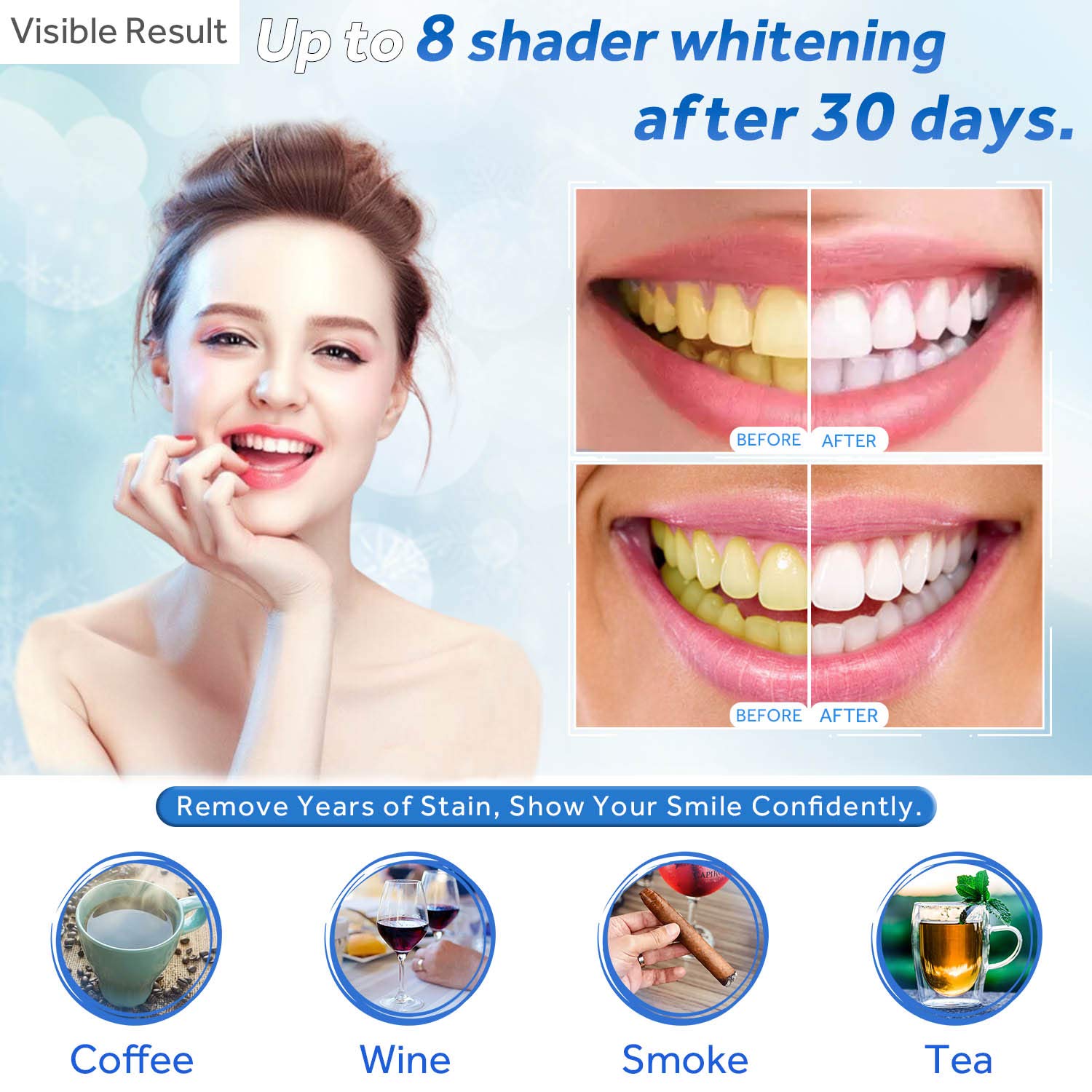 Jeringa de repuesto de Gel par - Teeth Whitening Near Me reseña y precio