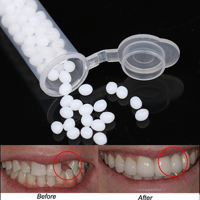 【K】1 caja: kit de reparación t - Teeth Whitening Kit reseña y precio